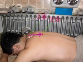 中醫(yī)拔罐養(yǎng)生 九大常用穴位
